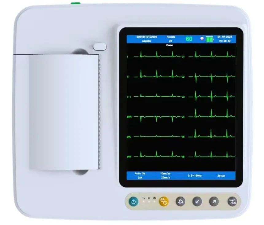 12-lead colour ECG machine used at Live Life Healthcare Lab, Udumalaipettai
